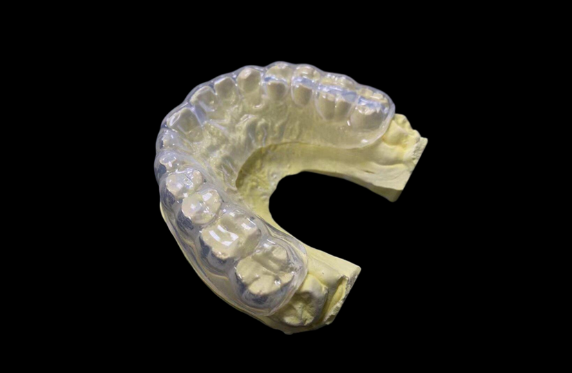 Take-Home Dental Whitening Trays